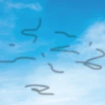 eye-floaters