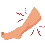 Muscle Cramping