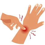 Pain from Light Touch