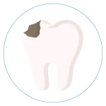 tooth-decay